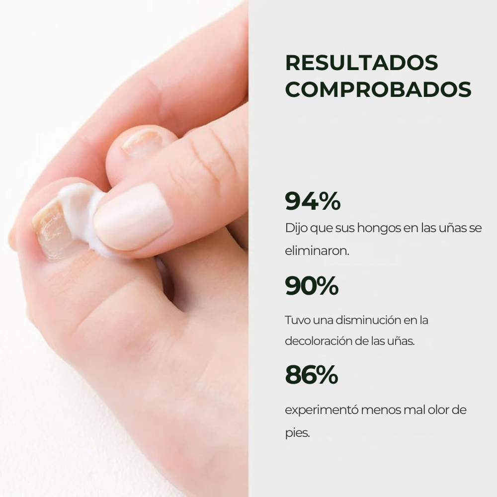 ByeFungus | Elimina los hongos de raíz