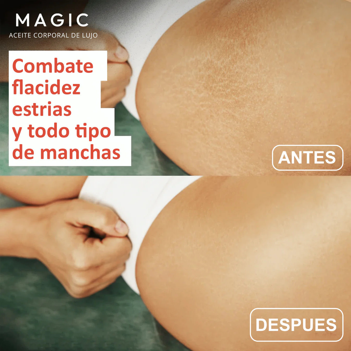 MagicBody™️ | Adiós Piel Suelta!, Sin Clínicas Ni Agujas