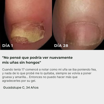 ByeFungus | Elimina los hongos de raíz