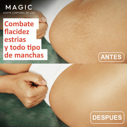 MagicBody™️ | Adiós Piel Suelta!, Sin Clínicas Ni Agujas